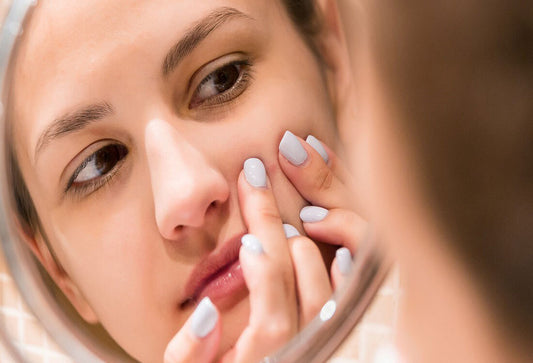 5 Surprising Acne Triggers - And How to Avoid Them