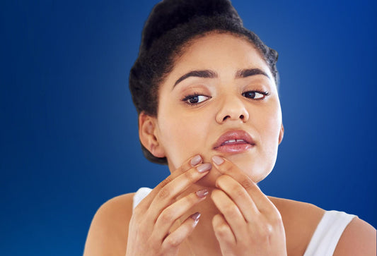 Acne Explained - How Pimples Form, Evolve, and Fade